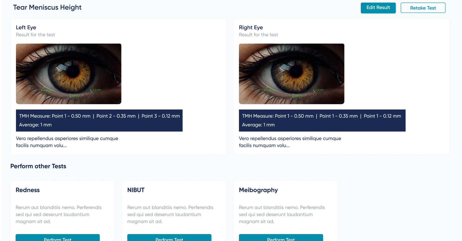 Tear-meniscus-height results for both eyes with TMH measurements, and a row of further tests — redness, NIBUT and meibography — each a click away.